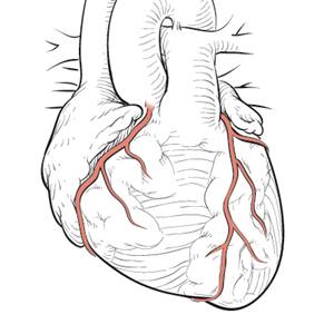 coronary-arteries