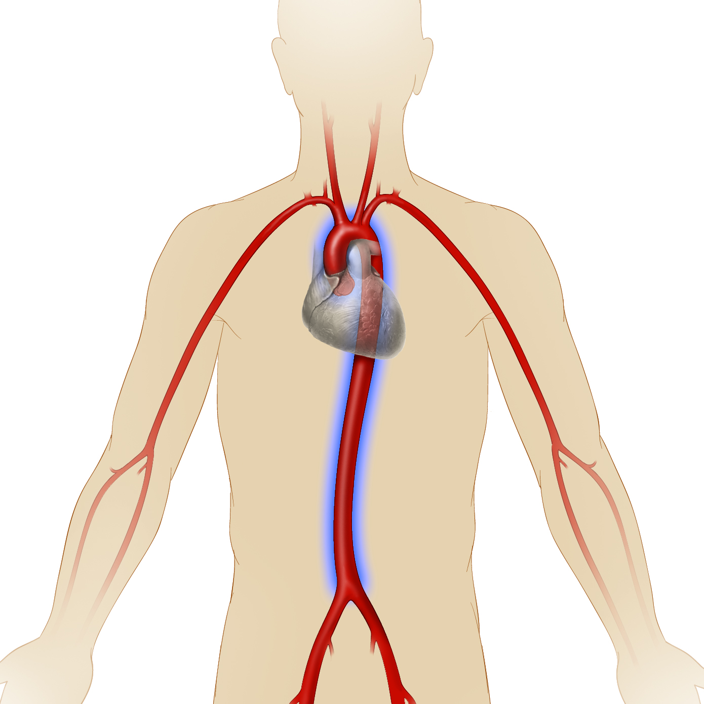 What Is Aortic Aneurysm Heart Care Intermountain Healthcare