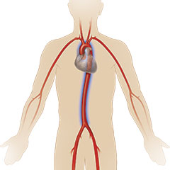 aorta-in-body
