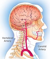 carotid-artery-fullwidth
