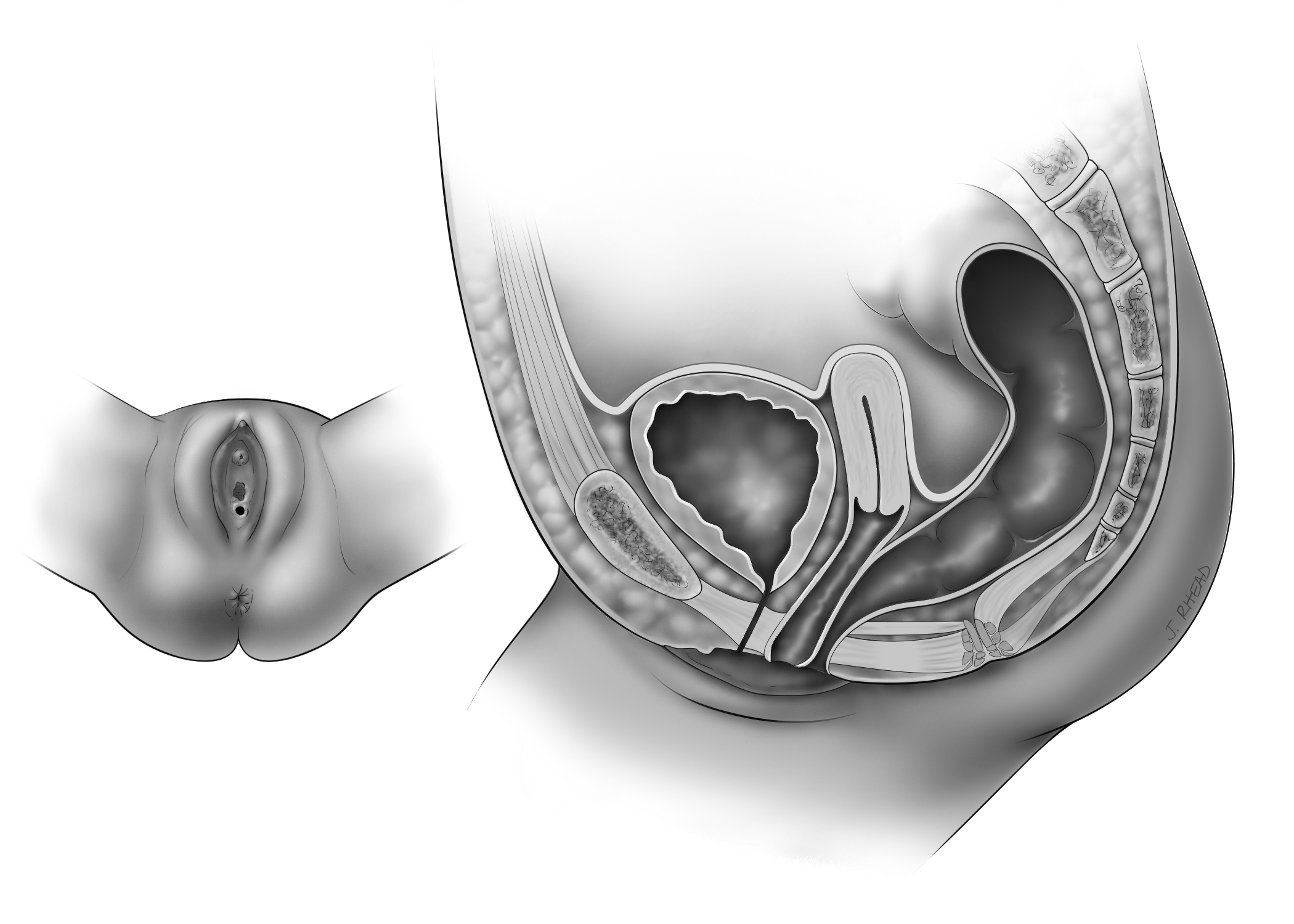 colorectalmed5