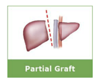 Partial liver