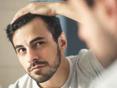 Male checks for hair loss