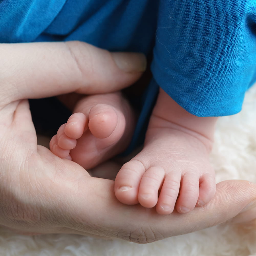 How to recognise if my baby's feet are normal or needs treatment? Clubfoot, baby  feet turning inward or outward