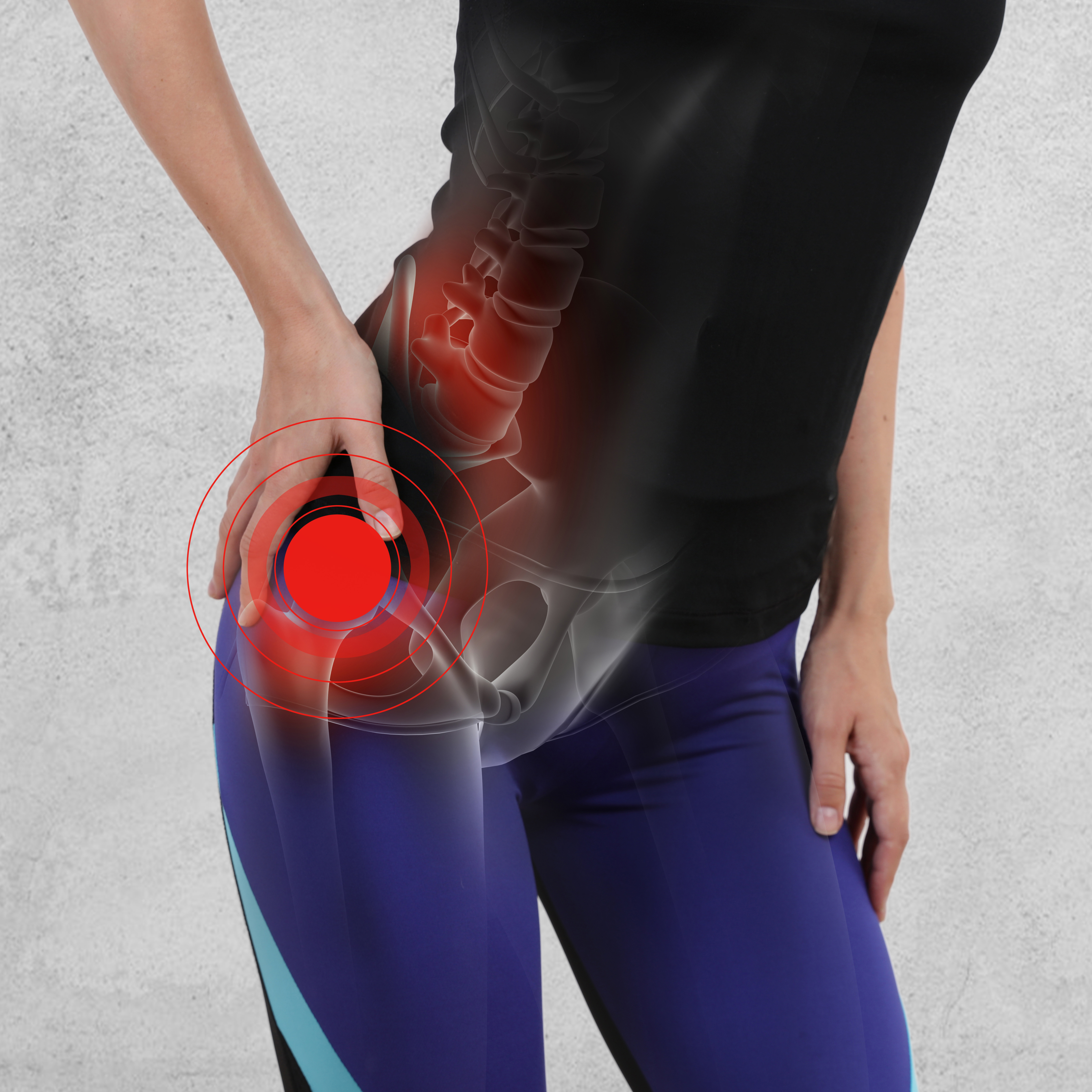 Learn the difference between conditions causing Outer Hip Pain
