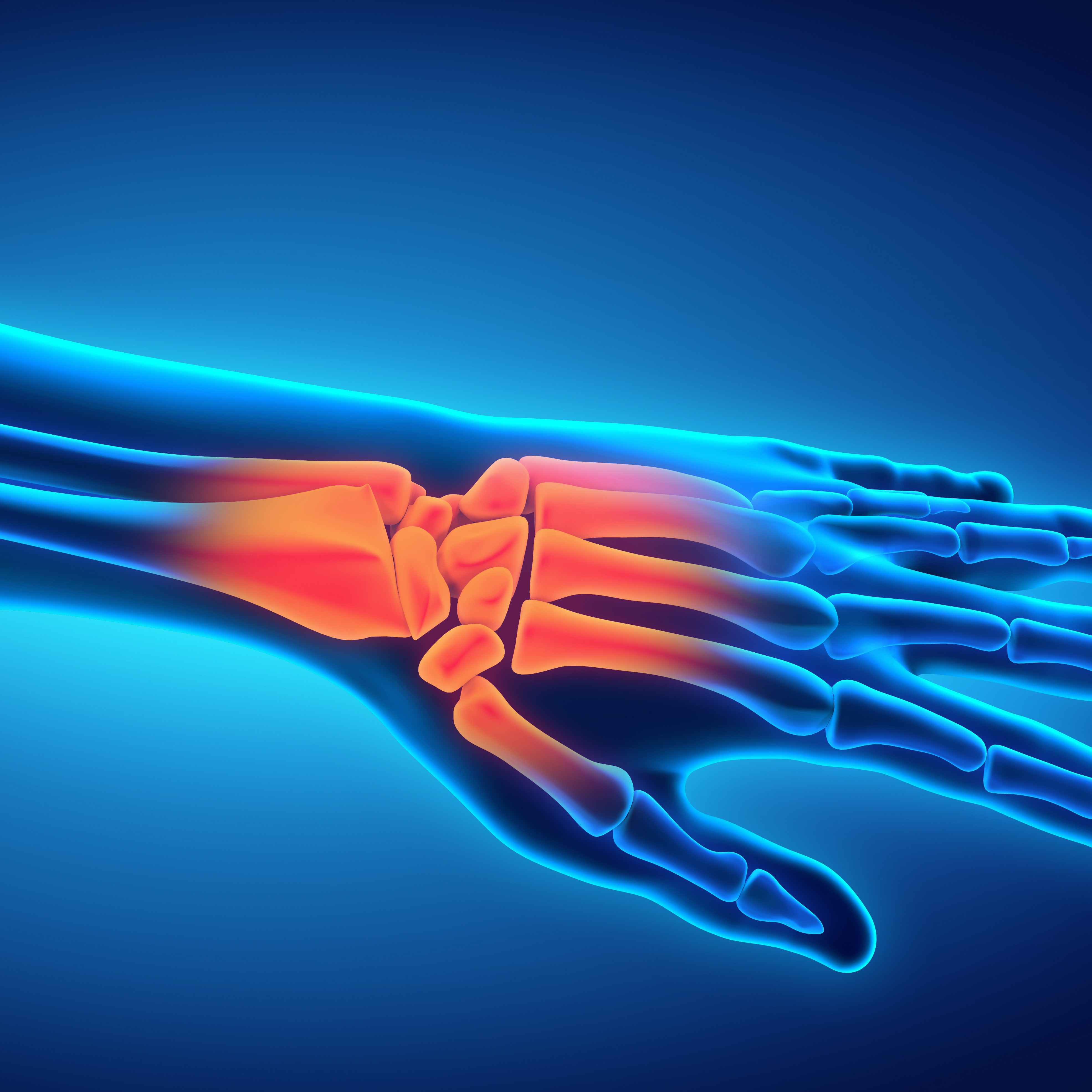 Wrist and Hand Specialist Near Me Orthopedics Sports Medicine