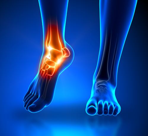 Foot and Ankle Pain - PacificPro Physical Therapy & Sports Medicine