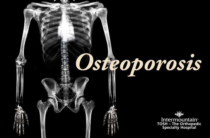 Osteoporosis-bone-image