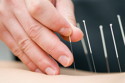 Acupuncture For Kids