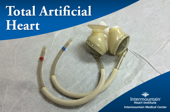 SynCardia-Total-Artificial-Heart