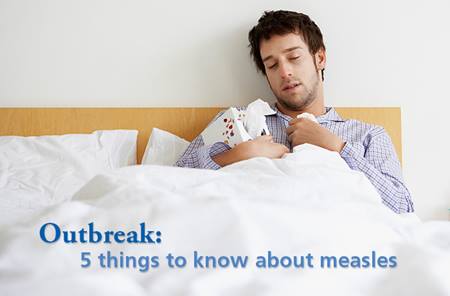measles-outbreak-what-you-should-know