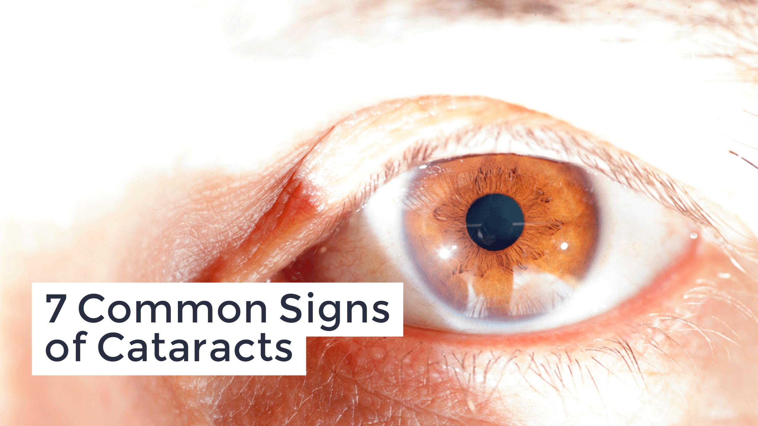 7 Symptoms Of Cataracts