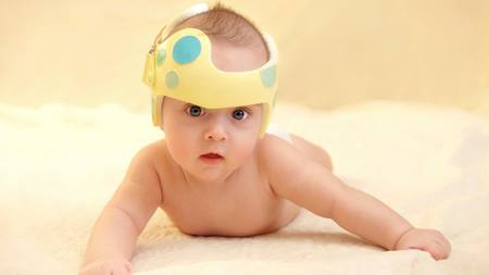 Does my infant need a helmet