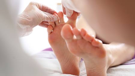 How to care for an infected toenail