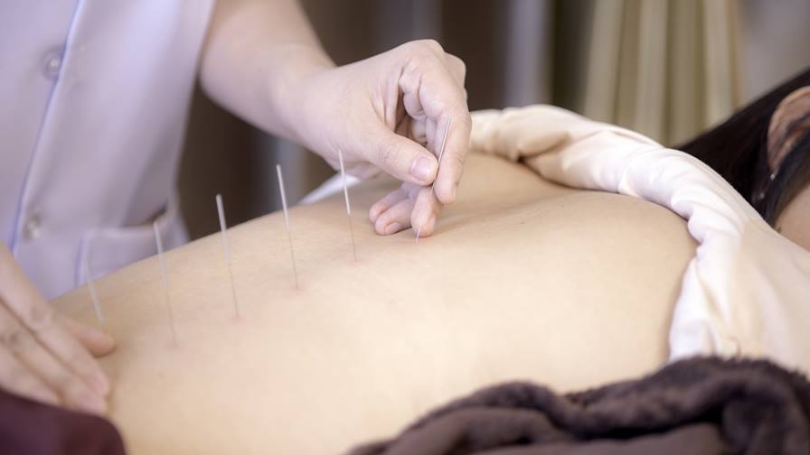 Why I Love Acupuncture