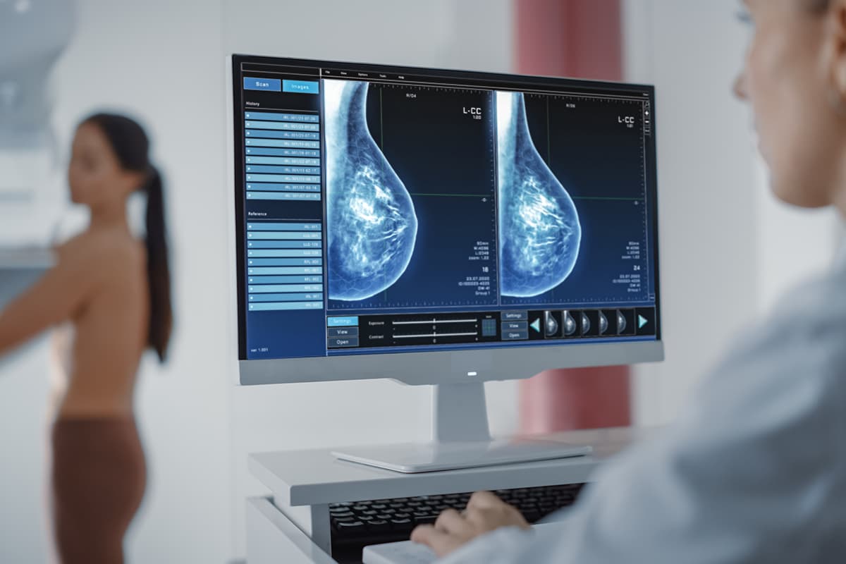 Mammography for breast cancer screening