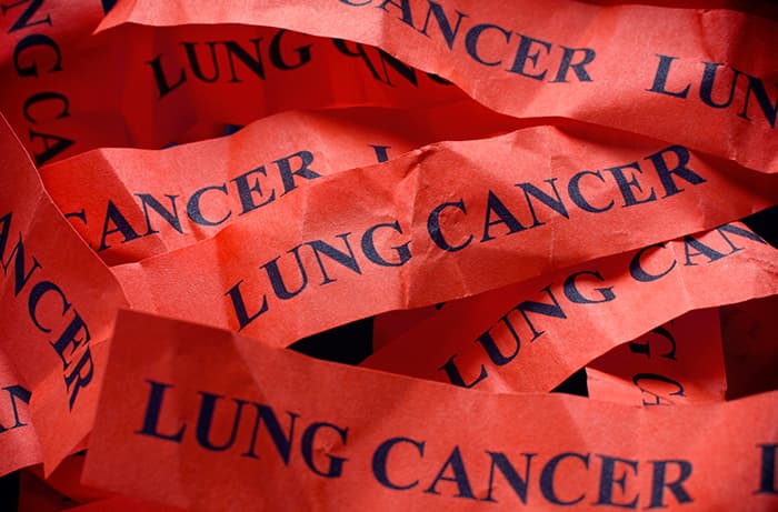 Lung_cancer_Screening