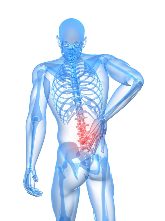 Illustration of a human figure with Lower-Back-Pain indicated